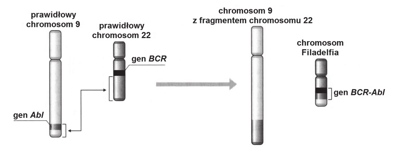 schemat przedstawiający chromosomy 9 i 22 przed mutacją oraz po niej - fragment chromosomu 9 zawierający gen Abl zostaje przeniesiony na chromosom 22 w miejsce genu BCR, w efekcie powstaje skrócony chromosom 22 nazywany chromosomem Filadelfia z genem fuzyjnym BCR-Abl